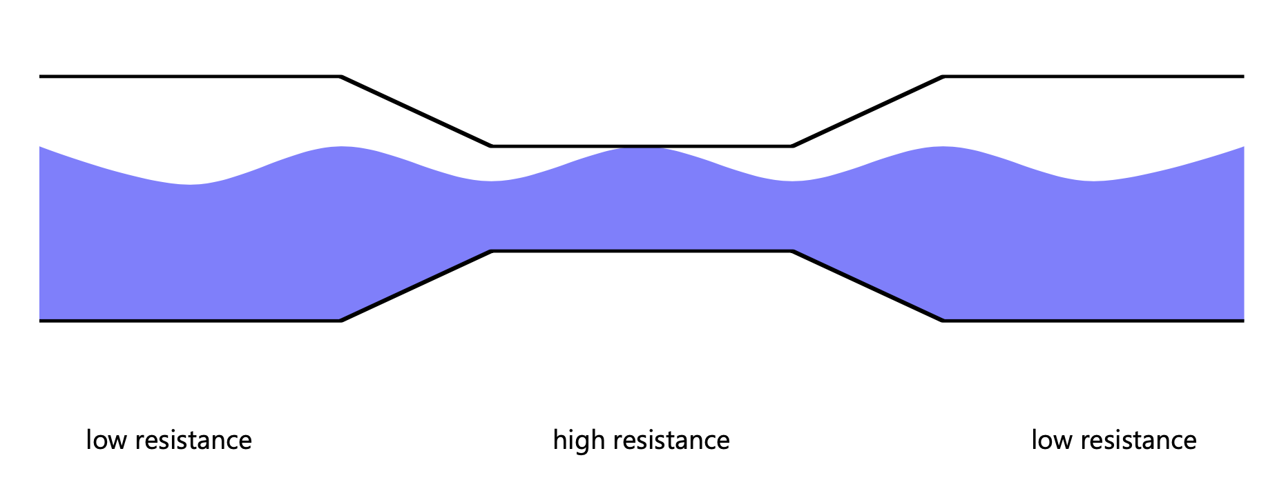 resistance